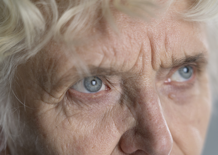 Visão embaçada sem cirurgia prévia pode ter muitas causas, A visão embaçada é um sintoma comum que pode surgir de forma repentina ou progressiva, afetando um ou ambos os olhos. Muitas pessoas acreditam que esse sintoma só aparece após traumas ou cirurgias, mas na verdade, há uma variedade de causas que não têm relação direta com procedimentos cirúrgicos. Saber reconhecer essas causas e buscar ajuda qualificada é essencial para evitar complicações visuais mais graves.

A Clínica Opto Prime, especializada em atenção primária à saúde visual, atua justamente na investigação precoce de sinais como a visão embaçada. Com avaliação optométrica clínica, é possível identificar desde simples alterações de refração até sinais de doenças mais sérias que afetam os olhos ou o sistema nervoso.

Causas comuns da visão embaçada (sem cirurgia)

Problemas de refração
Miopia, hipermetropia, astigmatismo e presbiopia são causas frequentes. Na Clínica Opto Prime, o exame optométrico identifica com precisão o grau ideal, promovendo alívio imediato da visão turva.

Catarata (fase inicial)
Mesmo sem cirurgia, a catarata pode começar a causar uma leve opacificação do cristalino, principalmente após os 50 anos.

Síndrome do olho seco
Ambientes com ar-condicionado, uso excessivo de telas e fatores hormonais contribuem para o ressecamento ocular, resultando em visão flutuante e borrada.

Doenças metabólicas como diabetes e hipertensão
A visão embaçada pode ser o primeiro sinal de retinopatia diabética ou hipertensiva. A avaliação primária da Opto Prime é essencial para encaminhamento e controle precoce.

Distúrbios neurológicos
Alterações na visão também podem indicar neurite óptica, enxaqueca com aura ou até sinais precoces de AVC. O profissional da Opto Prime é treinado para identificar essas alterações e encaminhar com urgência.

Fatores emocionais e hormonais
Estresse, ansiedade, alterações na tireoide e na menopausa podem gerar embaçamento visual passageiro.

Efeitos colaterais de medicamentos
Antidepressivos, antialérgicos e outros remédios podem impactar a qualidade da visão.

visaoembacada     optoprime  exameoptometrico      examedavista          saudevisual, Exame optométrico, Márcia Sousa Optometrista, em, Óptica e Optometria