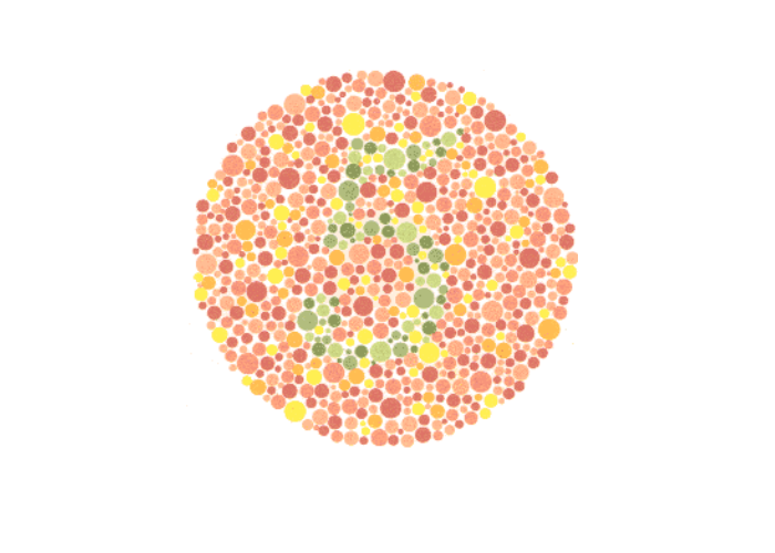 Quando os seus olhos veem: O que o teste de Ishihara pode revelar sobre a percepção das cores, A percepção das cores começa na retina

O teste de Ishihara é um recurso utilizado na triagem de alterações relacionadas à percepção das cores, dentro de uma avaliação visual realizada de forma individualizada e contextualizada.

Na prancha de Ishihara apresentada, algumas pessoas podem não identificar o número 8 formado pelos pontos coloridos. Essa dificuldade pode estar relacionada a alterações na percepção de determinadas cores, especialmente nas tonalidades associadas ao vermelho e ao verde. A interpretação deve considerar o conjunto da avaliação visual, pois uma única prancha não é suficiente para estabelecer um diagnóstico.

Enxergar uma cor envolve muito mais do que simplesmente observar uma imagem. A luz refletida pelos objetos é captada pela retina e processada por estruturas especializadas, incluindo os cones, células responsáveis por contribuir para a percepção de diferentes faixas do espectro luminoso. Quando existe uma alteração na função desses mecanismos, determinadas cores ou combinações cromáticas podem ser percebidas de maneira diferente. O teste de Ishihara utiliza pranchas com padrões formados por pontos coloridos para investigar, principalmente, possíveis dificuldades na identificação de determinadas tonalidades. Durante uma avaliação visual, a interpretação do resultado deve considerar o desempenho apresentado, as condições do teste e o contexto visual individual de cada pessoa. 
, Avaliação da visão de cores, Percepção visual e saúde ocular, em, Óptica e Optometria