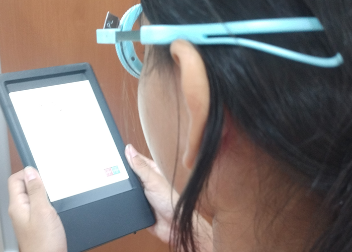 Armação curvada e conforto visual em lentes monofocais, Análise clínica de adaptação visual em paciente jovem utilizando lente monofocal com grau negativo, armação curvada e filtro azul.

Paciente de 28 anos procurou avaliação visual relatando desconforto durante o uso de seus óculos, principalmente em atividades prolongadas de visão próxima e durante períodos de exposição a telas digitais. O paciente utilizava lentes monofocais com prescrição aproximada de -1,00 dioptria esférica, -3,00 dioptrias cilíndricas no eixo 10º, montadas em uma armação com curvatura acentuada.

Durante a análise inicial, observou-se que alguns fatores relacionados ao conjunto óptico poderiam estar influenciando a percepção visual, como a geometria da armação, posição das lentes em relação aos olhos, parâmetros de montagem, adaptação ao astigmatismo corrigido e características individuais de sensibilidade visual.

A presença de uma armação mais curvada pode alterar a relação entre o eixo visual do usuário e a superfície da lente, podendo modificar a experiência perceptiva principalmente em prescrições com maior componente cilíndrico. Isso não significa necessariamente um erro na prescrição, mas indica a importância de avaliar a interação entre lente, armação e sistema visual., Protocolo OptoPrime avaliação visual, Sensibilidade ao filtro azul em lentes, em, Óptica e Optometria