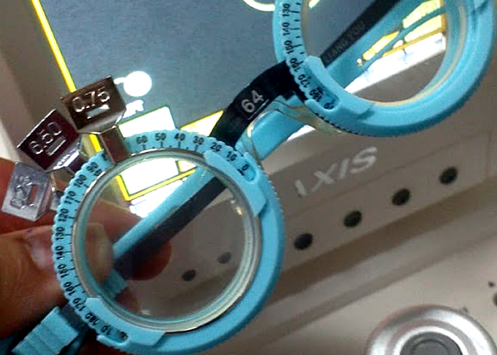 Alta miopia,  quando o grau elevado pode indicar uma condição que exige investigação mais ampla?, Alta miopia não é uma doença única

A expressão “alta miopia” geralmente é utilizada para descrever graus refrativos elevados, frequentemente associados a valores de aproximadamente −6,00 dioptrias ou mais. Entretanto, o valor da refração, isoladamente, não descreve toda a condição ocular. A extensão axial do olho, as características da retina, da mácula, do nervo óptico e de outras estruturas também podem contribuir para a compreensão do quadro visual. Por isso, uma pessoa com alta miopia pode apresentar diferentes características anatômicas e funcionais, com necessidades de acompanhamento que não são necessariamente iguais. A chamada miopia patológica, por sua vez, está relacionada à presença de alterações estruturais típicas, especialmente no segmento posterior do olho, e não apenas à intensidade do grau refrativo.

O que pode diferenciar uma alta miopia de alterações associadas à miopia patológica?

A diferenciação entre uma elevada magnitude refrativa e a presença de alterações estruturais exige uma análise clínica individualizada. Alterações como atrofias coriorretinianas, lesões maculares, alterações relacionadas ao alongamento ocular, estafiloma posterior e outras modificações do fundo de olho podem modificar a interpretação do caso. Por essa razão, a avaliação da pessoa com alta miopia não deve se limitar à tentativa de alcançar determinado número na tabela de acuidade visual. A história visual, a evolução do grau, a qualidade da visão, a percepção de distorções, a avaliação binocular e a análise das estruturas oculares podem contribuir para uma compreensão mais completa da condição visual.

Sinais de alerta clínicos

Alguns sintomas visuais merecem atenção especial, principalmente quando surgem de forma súbita ou apresentam mudança progressiva. Percepção de flashes luminosos, aumento repentino de manchas ou pontos flutuantes, sensação de sombra ou cortina no campo visual, distorção de linhas retas, redução inesperada da visão central ou alterações visuais novas podem justificar avaliação clínica com maior brevidade. Esses sinais não permitem, por si só, estabelecer um diagnóstico, mas podem indicar a necessidade de investigação por profissional habilitado. Em pessoas com alta miopia, o acompanhamento deve considerar o risco aumentado de determinadas alterações oculares, sem transformar esse risco em uma previsão individual de que determinada complicação necessariamente ocorrerá.

, Exame de vista na OptoPrime, Controle da miopia, em, Óptica e Optometria