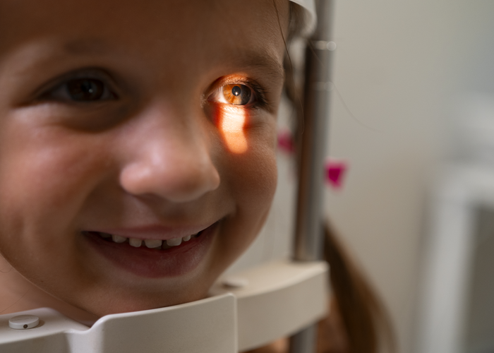 Protocolo OptoPrime, Brincar faz parte do desenvolvimento físico, emocional e cognitivo da criança. Entretanto, determinadas brincadeiras e alguns brinquedos podem representar riscos importantes para os olhos quando utilizados sem supervisão ou de forma inadequada. Lesões oculares podem variar desde pequenos traumatismos superficiais até alterações que exigem atendimento de urgência e acompanhamento especializado.

No Protocolo OptoPrime de Saúde Visual, a prevenção ocupa um papel central. Além da avaliação da acuidade visual e da função binocular, a orientação aos pais e responsáveis faz parte do atendimento, contribuindo para reduzir situações que possam comprometer a saúde ocular durante a infância., Trauma ocular por brinquedos, Prevenção de lesões oculares, em, Óptica e Optometria