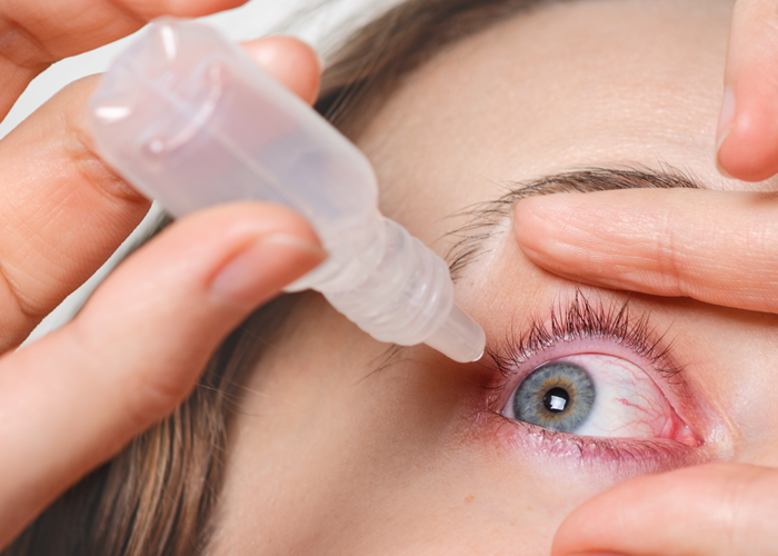 Uso de corticoides e a saúde da visão - O que você precisa saber, Os corticoides são medicamentos amplamente utilizados no tratamento de inflamações, alergias, doenças autoimunes e outras condições crônicas. Porém, seu uso, especialmente quando prolongado ou sem acompanhamento adequado, pode trazer riscos sérios à saúde ocular.


Prevenção começa com um olhar atento!

, Exame OptoPrime, Manoa Exame de vista, em, Óptica e Optometria