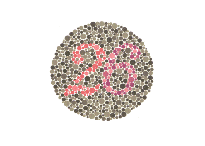 Quando os seus olhos veem: O que o teste de Ishihara pode revelar sobre a percepção das cores, A percepção das cores começa na retina

O teste de Ishihara é um recurso utilizado na triagem de alterações relacionadas à percepção das cores, dentro de uma avaliação visual realizada de forma individualizada e contextualizada.

Na prancha de Ishihara apresentada, algumas pessoas podem não identificar o número 8 formado pelos pontos coloridos. Essa dificuldade pode estar relacionada a alterações na percepção de determinadas cores, especialmente nas tonalidades associadas ao vermelho e ao verde. A interpretação deve considerar o conjunto da avaliação visual, pois uma única prancha não é suficiente para estabelecer um diagnóstico.

Enxergar uma cor envolve muito mais do que simplesmente observar uma imagem. A luz refletida pelos objetos é captada pela retina e processada por estruturas especializadas, incluindo os cones, células responsáveis por contribuir para a percepção de diferentes faixas do espectro luminoso. Quando existe uma alteração na função desses mecanismos, determinadas cores ou combinações cromáticas podem ser percebidas de maneira diferente. O teste de Ishihara utiliza pranchas com padrões formados por pontos coloridos para investigar, principalmente, possíveis dificuldades na identificação de determinadas tonalidades. Durante uma avaliação visual, a interpretação do resultado deve considerar o desempenho apresentado, as condições do teste e o contexto visual individual de cada pessoa. 
, Avaliação da visão de cores, Percepção visual e saúde ocular, em, Óptica e Optometria