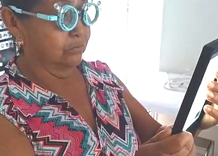 Vias lacrimais, Anatomia das vias lacrimais

Anatomia funcional das vias lacrimais, destacando a glândula lacrimal, os pontos lacrimais, os canalículos, o saco lacrimal e o ducto nasolacrimal, estruturas responsáveis pela produção e drenagem fisiológica da lágrima.

O sistema lacrimal desempenha papel fundamental na manutenção da superfície ocular, proporcionando lubrificação, proteção imunológica, estabilidade óptica e conforto visual. Alterações discretas nesse sistema podem provocar sintomas importantes, como visão oscilante, ardor, sensação de areia, lacrimejamento excessivo e intolerância ao uso de lentes.

No Protocolo OptoPrime, a avaliação das vias lacrimais não é realizada apenas quando o paciente apresenta queixas de olho seco ou epífora (lacrimejamento excessivo dos olhos). Ela faz parte da investigação funcional da qualidade visual, pois a estabilidade do filme lacrimal influencia diretamente a refração, a sensibilidade ao contraste, a percepção de detalhes e o desempenho binocular.

Objetivos do Protocolo OptoPrime

A avaliação funcional das vias lacrimais busca:

Identificar alterações da produção lacrimal
A avaliação da produção lacrimal permite identificar alterações quantitativas da lágrima, fornecendo informações importantes sobre a lubrificação da superfície ocular e o equilíbrio do sistema lacrimal.

Avaliar a estabilidade do filme lacrimal, a estabilidade do filme lacrimal é essencial para manter a superfície ocular regular, favorecer a qualidade óptica e proporcionar conforto durante as atividades visuais.


Detectar sinais precoces de disfunção das glândulas palpebrais, a análise das glândulas palpebrais possibilita reconhecer precocemente alterações que podem comprometer a camada lipídica da lágrima e favorecer sua evaporação.

Investigar alterações da drenagem lacrimal, a investigação do sistema de drenagem lacrimal auxilia na identificação de alterações funcionais relacionadas ao escoamento da lágrima, contribuindo para uma avaliação clínica mais abrangente.


Diferenciar lacrimejamento reflexo de deficiência lacrimal
A diferenciação entre lacrimejamento reflexo e redução da produção lacrimal é importante para direcionar a interpretação dos sinais clínicos e orientar a conduta adequada durante a avaliação optométrica.

Reduzir a probabilidade de erros refracionais decorrentes da instabilidade do filme lacrimal
No Protocolo OptoPrime, a estabilização da superfície ocular antes do refinamento refracional contribui para aumentar a confiabilidade dos resultados e reduzir a probabilidade de variações induzidas pela instabilidade do filme lacrimal.


Anatomia Funcional

O sistema lacrimal é dividido em dois grandes componentes:

Sistema Secretor
O sistema secretor é formado por glândulas especializadas que produzem os diferentes componentes do filme lacrimal, contribuindo para a lubrificação, proteção e estabilidade óptica da superfície ocular.

Responsável pela produção da lágrima, inclui:

Glândula lacrimal principal
A glândula lacrimal principal é responsável pela maior parte da produção aquosa da lágrima, desempenhando papel importante na proteção, hidratação e resposta reflexa da superfície ocular.

Glândulas lacrimais acessórias
As glândulas lacrimais acessórias contribuem para a manutenção contínua do filme lacrimal, auxiliando na lubrificação fisiológica da superfície ocular durante as atividades diárias.

Glândulas de Meibômio
As glândulas de Meibômio produzem a camada lipídica do filme lacrimal, reduzindo a evaporação da lágrima e favorecendo maior estabilidade e conforto visual.

Glândulas de Zeis
As glândulas de Zeis estão associadas aos folículos ciliares e participam da produção de secreção lipídica que auxilia na proteção da margem palpebral.

Glândulas de Moll
As glândulas de Moll localizam-se na margem das pálpebras e contribuem para a manutenção do ambiente palpebral, integrando o sistema secretor da superfície ocular.

Células caliciformes da conjuntiva
As células caliciformes produzem mucinas que promovem a aderência da lágrima à superfície ocular, favorecendo a uniformidade do filme lacrimal e a qualidade óptica da córnea.


Cada estrutura contribui para a estabilidade do filme lacrimal.

Sistema Excretor
O sistema excretor é responsável pela drenagem fisiológica da lágrima, permitindo o escoamento adequado do excesso de secreção para a cavidade nasal.


Responsável pela drenagem fisiológica

Compreende:

Pontos lacrimais
Os pontos lacrimais constituem a porta de entrada do sistema de drenagem, captando a lágrima presente na margem palpebral durante o piscar.

Canalículos lacrimais
Os canalículos lacrimais conduzem a lágrima dos pontos lacrimais em direção ao saco lacrimal, participando do mecanismo fisiológico de drenagem.

Canalículo comum
O canalículo comum representa a união dos canalículos superior e inferior antes da chegada da lágrima ao saco lacrimal.

Saco lacrimal
O saco lacrimal funciona como reservatório temporário da lágrima antes de sua drenagem pelo ducto nasolacrimal.

Ducto nasolacrimal
O ducto nasolacrimal conduz a lágrima até a cavidade nasal, completando o processo fisiológico de drenagem do sistema lacrimal.


Qualquer obstrução nesse trajeto pode resultar em epífora e aumento do risco de infecções.

Estrutura do Filme Lacrimal

No Protocolo OptoPrime, o filme lacrimal é compreendido como uma estrutura dinâmica composta por três componentes funcionais.

Camada Lipídica, localizada externamente
Localizada na porção mais externa do filme lacrimal, a camada lipídica atua como uma barreira protetora contra a evaporação excessiva da lágrima, contribuindo para a estabilidade do filme lacrimal, a manutenção da superfície ocular e a otimização da qualidade óptica durante a formação da imagem retiniana.


Principais funções:

Reduzir evaporação
A camada lipídica, produzida principalmente pelas glândulas de Meibômio, reduz a evaporação da lágrima e favorece a estabilidade do filme lacrimal, desempenhando papel importante no conforto ocular e na qualidade da visão.

Estabilizar o filme lacrimal
A estabilidade do filme lacrimal mantém a superfície ocular uniformemente recoberta pela lágrima, reduzindo irregularidades ópticas e contribuindo para uma visão mais estável e confortável durante o piscar.

Melhorar a qualidade óptica da superfície ocular
Um filme lacrimal íntegro favorece a formação de uma superfície óptica regular sobre a córnea, reduzindo a dispersão da luz e contribuindo para maior nitidez, contraste e qualidade visual.

Sua deficiência favorece o olho seco evaporativo
a avaliação da camada lipídica do filme lacrimal auxilia na identificação de alterações que podem comprometer a estabilidade da superfície ocular, interferir na qualidade visual e influenciar a confiabilidade da avaliação refracional.


Camada Aquosa, representa a maior parte do volume lacrimal

Funções:

Hidratação da córnea
A camada aquosa do filme lacrimal mantém a hidratação contínua da córnea, preservando a transparência, a integridade do epitélio e o conforto durante as atividades visuais.

Transporte de nutrientes
A lágrima atua como meio de transporte para oxigênio, eletrólitos, proteínas e outros nutrientes essenciais, contribuindo para o metabolismo e a manutenção da superfície ocular.

Remoção de partículas
O fluxo fisiológico da lágrima auxilia na remoção de poeira, microrganismos e resíduos presentes na superfície ocular, favorecendo a limpeza e a proteção dos tecidos oculares.

Defesa imunológica
Além de lubrificar a superfície ocular, o filme lacrimal contém componentes de defesa que contribuem para a proteção contra agentes potencialmente nocivos e para a manutenção do equilíbrio da microbiota ocular.

Camada de Mucinas
A camada de mucinas permanece aderida ao epitélio ocular, promovendo maior aderência da lágrima à superfície da córnea e da conjuntiva, favorecendo a estabilidade do filme lacrimal.

As mucinas aumentam a capacidade de adesão da lágrima ao epitélio ocular, reduzindo áreas de instabilidade e melhorando a cobertura da superfície ocular.

Funções:

Fica aderida ao epitélio ocular a aderência da lágrima

A aderência da camada de mucinas ao epitélio ocular permite a distribuição uniforme da lágrima durante o piscar, contribuindo para uma superfície óptica mais regular e confortável. 

Uniformizar a superfície óptica
A distribuição homogênea das mucinas contribui para formar uma superfície refrativa mais regular, favorecendo a qualidade da imagem projetada na retina.

Promover melhor espalhamento do filme lacrimal.
Durante o piscar, a camada de mucinas facilita o espalhamento uniforme do filme lacrimal sobre a superfície ocular, contribuindo para maior estabilidade visual e conforto., Avaliação da superfície ocular, Protocolo optoprime, em, Óptica e Optometria