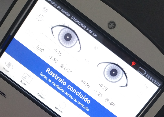 OPTOBEM – Centro de Pesquisa e Desenvolvimento em Optometria Clínica, A OPTOBEM nasce com a missão de elevar o padrão da Optometria Clínica por meio da integração entre conhecimento científico, tecnologia e atendimento humanizado. Em parceria com a Clínica OPTO PRIME – Exame de Vista no Manoa, desenvolvemos protocolos clínicos próprios que ampliam a investigação da saúde visual, permitindo uma avaliação mais completa das funções oculares, da visão binocular, da acomodação, das vias ópticas e da percepção visual. Nosso objetivo é oferecer uma experiência clínica baseada em evidências, contribuindo para a promoção da saúde visual e para a identificação precoce de alterações funcionais.

Conhecimento científico, inovação e atendimento humanizado para cuidar da sua visão.

Em parceria com a Clínica OPTO PRIME – Exame de Vista no Manoa, desenvolvemos protocolos clínicos exclusivos que valorizam uma avaliação visual abrangente, contribuindo para a promoção da saúde visual, da qualidade de vida e do cuidado integral com cada paciente. Essa abordagem une pesquisa, prática clínica e educação em saúde para oferecer um atendimento diferenciado e baseado nas melhores evidências disponíveis.

Mais do que realizar uma simples refração, a OPTOBEM busca compreender como os olhos e o cérebro trabalham em conjunto para formar a visão. Nossos protocolos clínicos avaliam aspectos importantes do sistema visual, como motilidade ocular, vergências, reservas fusionais, resposta acomodativa, sensibilidade ao contraste, visão de cores, integração sensorial e rastreamento de possíveis alterações neurovisuais. Cada paciente é atendido de forma individualizada, respeitando suas necessidades visuais e sua história clínica.

No Centro de Pesquisa e Desenvolvimento em Optometria Clínica, os Protocolos OPTO PRIME representam um diferencial exclusivo. Eles foram estruturados para auxiliar na investigação de diversas condições relacionadas à visão, oferecendo suporte técnico ao raciocínio clínico e contribuindo para decisões mais seguras durante a avaliação optométrica. Essa abordagem reforça o compromisso da OPTOBEM com a inovação, a pesquisa científica e a melhoria contínua dos serviços prestados.

Além da prática clínica, a OPTOBEM dedica-se à produção de conteúdo científico, desenvolvimento de materiais educativos e criação de protocolos voltados à educação em saúde visual. Nosso compromisso é compartilhar conhecimento com estudantes, profissionais da área da saúde e com a comunidade, promovendo a conscientização sobre a importância da prevenção, do acompanhamento periódico e da preservação da visão em todas as fases da vida.

Na Clínica OPTO PRIME, localizada no bairro Manoa, cada exame é conduzido com ética, responsabilidade e atenção aos detalhes. Acreditamos que enxergar bem é resultado da integração entre ciência, tecnologia e cuidado com as pessoas. Por isso, investimos continuamente no aperfeiçoamento dos nossos protocolos clínicos, oferecendo uma avaliação visual moderna, acolhedora e baseada nas melhores práticas da Optometria Clínica., Protocolos OPTOBEM, Optometrista Manaus, em, Óptica e Optometria
