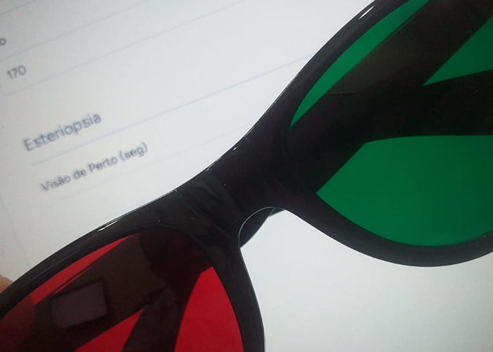 Função da optometria na avaliação da visão e na identificação de alterações na percepção de cores, A optometria tem como uma de suas principais funções realizar a avaliação do sistema visual, considerando não apenas a nitidez da visão, mas também aspectos relacionados à percepção visual, ao conforto e à forma como cada pessoa utiliza a visão em suas atividades diárias. Em casos de alterações na percepção das cores, como quadros sugestivos de protanomalia, a avaliação optométrica pode contribuir para a identificação de características visuais que merecem acompanhamento e orientação individualizada.

Avaliação visual e percepção das cores

A protanomalia é uma alteração relacionada à percepção da região das cores vermelhas, podendo influenciar a forma como determinadas tonalidades são percebidas e diferenciadas. No caso apresentado, a avaliação clínica identificou um quadro sugestivo de alteração na percepção do vermelho, associado a um período aproximado de três anos sem utilização de óculos. Em um paciente a acuidade visual sem correção registrada foi de 20/125 em ambos os olhos, enquanto, com a correção óptica avaliada, alcançou 20/40 binocularmente. Esses dados devem ser interpretados dentro do conjunto da avaliação visual, considerando as características individuais do paciente e os demais achados clínicos.

, Exame de vista na OptoPrime, Manoa Exame de vista, em, Óptica e Optometria