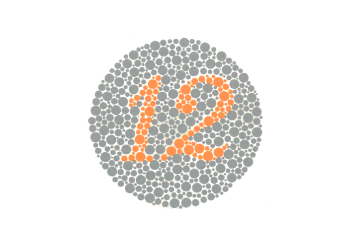 Teste de Ishihara, A percepção das cores começa na retina

O teste de Ishihara é um recurso utilizado na triagem de alterações relacionadas à percepção das cores, dentro de uma avaliação visual realizada de forma individualizada e contextualizada.

Na prancha de Ishihara apresentada, algumas pessoas podem não identificar o número 8 formado pelos pontos coloridos. Essa dificuldade pode estar relacionada a alterações na percepção de determinadas cores, especialmente nas tonalidades associadas ao vermelho e ao verde. A interpretação deve considerar o conjunto da avaliação visual, pois uma única prancha não é suficiente para estabelecer um diagnóstico.

Enxergar uma cor envolve muito mais do que simplesmente observar uma imagem. A luz refletida pelos objetos é captada pela retina e processada por estruturas especializadas, incluindo os cones, células responsáveis por contribuir para a percepção de diferentes faixas do espectro luminoso. Quando existe uma alteração na função desses mecanismos, determinadas cores ou combinações cromáticas podem ser percebidas de maneira diferente. O teste de Ishihara utiliza pranchas com padrões formados por pontos coloridos para investigar, principalmente, possíveis dificuldades na identificação de determinadas tonalidades. Durante uma avaliação visual, a interpretação do resultado deve considerar o desempenho apresentado, as condições do teste e o contexto visual individual de cada pessoa. 
, Avaliação da visão de cores, Percepção visual e saúde ocular, em, Óptica e Optometria